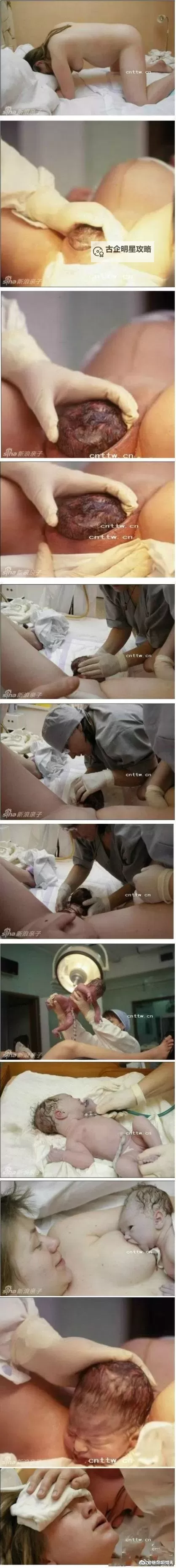 真实记录：孕妇分娩视频过程全景揭秘图1