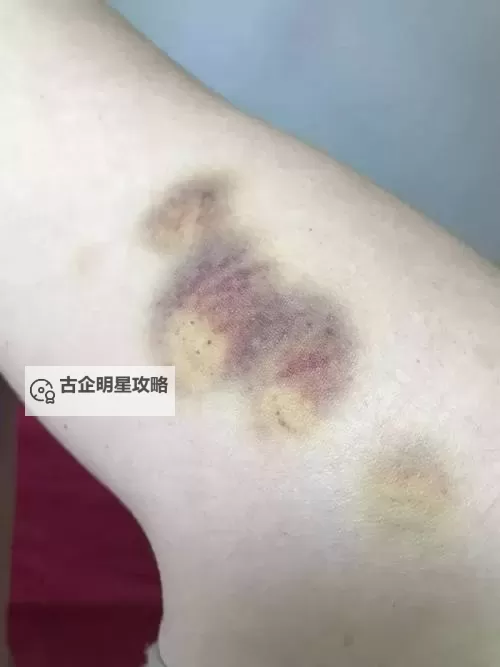 紫黑色肿大横冲直撞:黑暗中的异变惊魂记图1