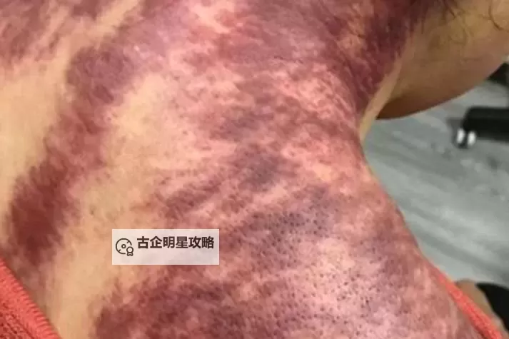 紫黑色肿大横冲直撞:黑暗中的异变惊魂记图2