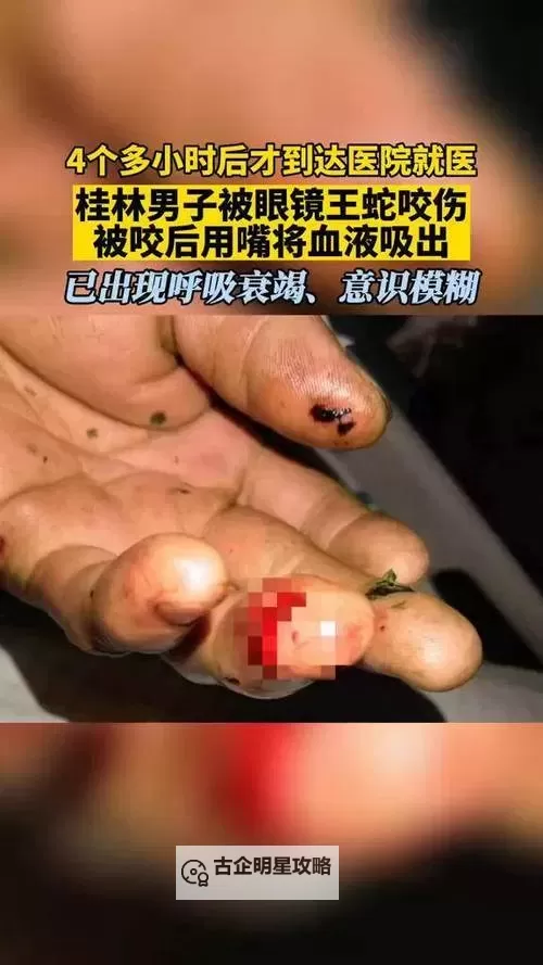 婚姻真相大曝光：丈夫用嘴吸了4年背后的秘密图1